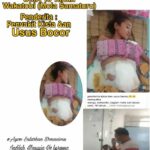 Bantu Elsa Penderita Penyakit Kista dan Usus Bocor